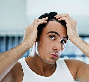 10 beste remedies voor kaalheid (alopecia)